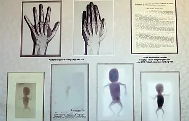 Prvé röntgenové snímky