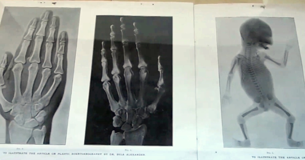 Röntgenové snímky